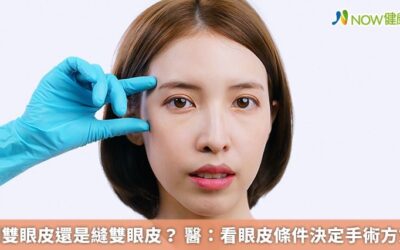 割雙眼皮還是縫雙眼皮? 醫:看眼皮條件決定手術方式
