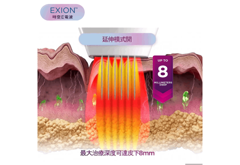 時空E電波(EXION )獨家延伸模式,能量穿透深度可直達深層真皮層(最高達 8mm),全身都適用