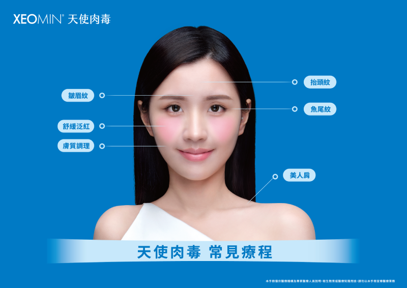 德國Xeomin天使肉毒為什麼安全又抗藥性？